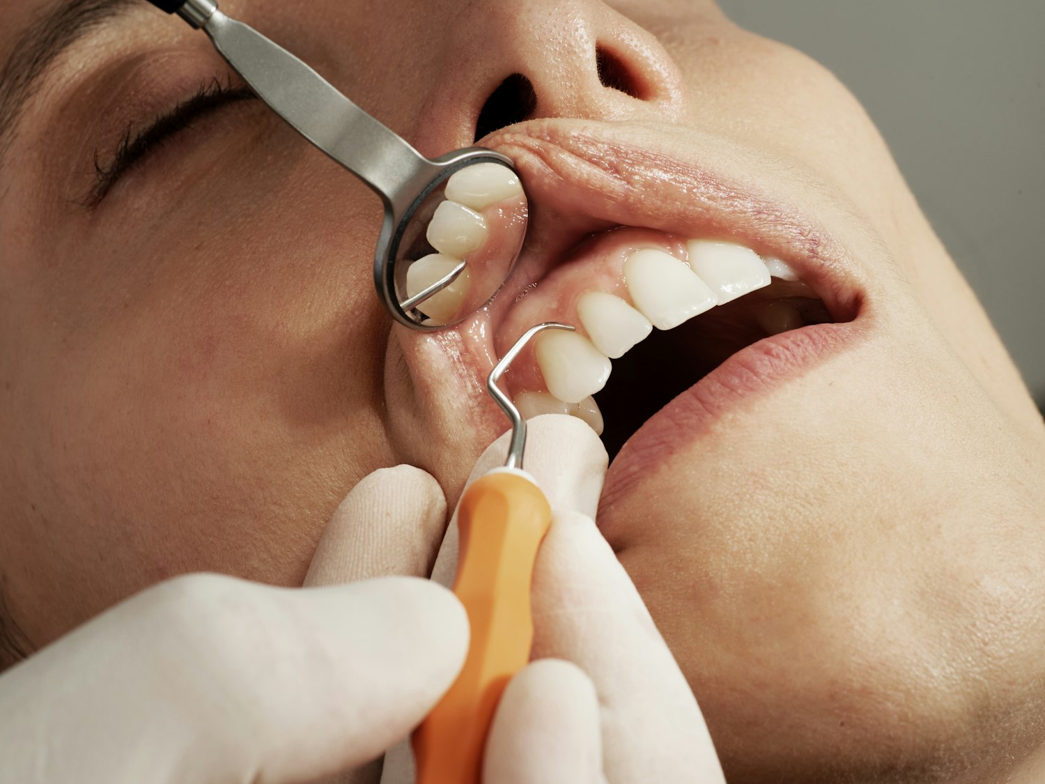 Rehabilitación estética en consultorio